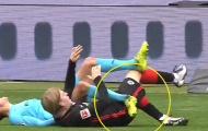 Cầu thủ Bundesliga gãy chân sau pha va chạm