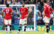 MU thua thảm Brighton: Thật hổ thẹn, Quỷ đỏ!