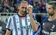 Chiellini đổ máu lần cuối cho Juventus