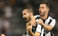 'Tôi ghét Chiellini'