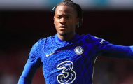 Batshuayi kể tội lỗi của Conte khi còn ở Chelsea