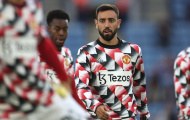 Bruno Fernandes phải thay đổi