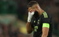 Chấn thương của Benzema không nghiêm trọng