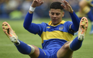 Cựu sao Man Utd thể hiện hàng loạt hình ảnh xấu xí