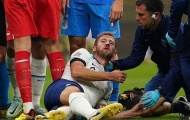 Kane lộ hình ảnh rợn người trong ngày ĐT Anh thua Italia