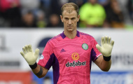 Joe Hart: 'Cậu ấy có thể làm gì, chặt cánh tay của mình?'
