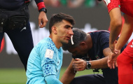 Rủi ro khi cho thủ môn Iran vào sân sau va chạm mạnh ở đầu