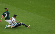 Messi và 3 cầu thủ Argentina tệ nhất trước Saudi Arabia