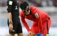 Son Heung-min gặp sự cố ở trận gặp Uruguay