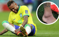 Neymar tiến triển thần tốc
