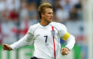 Những kiểu tóc xấu nhất lịch sử World Cup