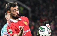 Thắng Burnley, Man Utd tổn thất lớn với 'số 10'