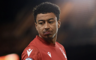 Lingard chỉ trích Man Utd
