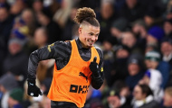 Pep Guardiola: Kalvin Phillips có thân hình thật gợi cảm