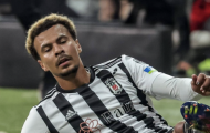 Sự nghiệp Dele Alli tiếp tục lao dốc