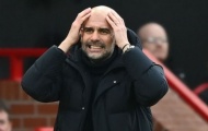 Pep Guardiola ngạc nhiên với Man United