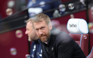 Graham Potter: 'Có những người nghĩ tôi là vấn đề'