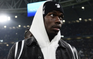 Pogba là thương vụ hớ của Juventus