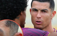 Ronaldo để lộ tóc bạc