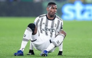 Vấn đề của Pogba