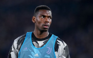 Pogba nghỉ gần như cả mùa, Allegri lên tiếng