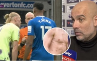 Pep Guardiola sôi máu Haaland bị hậu vệ Everton cào cấu khắp người