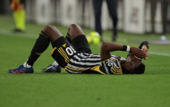 Vấn đề trầm kha của Juventus