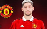 Bản hợp đồng nâng cấp tuyến giữa Man United