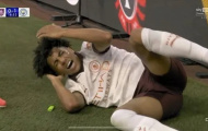 Sao Man City nằm sân đau đớn vì bị tấn công