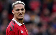 Berbatov ức chế, văng tục khi nhắc đến M.U