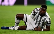 Pogba phơi bày sự thật về việc dính doping