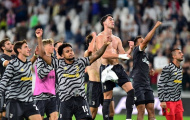 Max Allegri thừa nhận điểm hạn chế lớn của Juventus