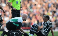 16 ca chấn thương xé toạc đội hình Man Utd, Ten Hag điên tiết