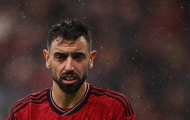 Ngã ngửa Bruno Fernandes