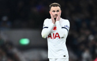 Không còn nhận ra James Maddison 
