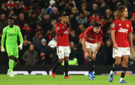 Xấu hổ quá Man Utd