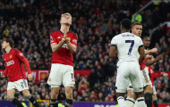 4 điểm đen trong chiến thắng của Man Utd: Cú sốc Ten Hag