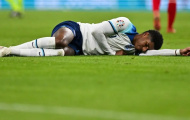 Rashford chấn thương khi va chạm với chính đồng đội