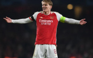 Arteta giải đáp thắc mắc bào sức Odegaard