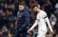 Postecoglou lần đầu xác nhận sao Tottenham phải ngồi ngoài