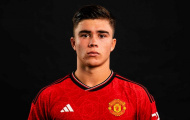 Quên Alvaro Fernandez đi, M.U đã có người thừa kế của Luke Shaw