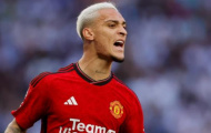 Ten Hag nêu tên 3 cầu thủ trẻ xứng đáng đá chính hơn Antony