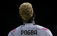 Pogba và 5 điều tệ nhất từng xảy đến với anh