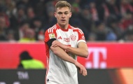 5 điểm đến tiềm năng cho Kimmich