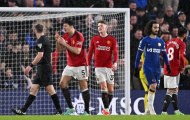 Man United thua Chelsea vậy mà hay