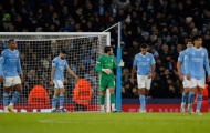 Sam Allardyce chỉ rõ 1 điều Guardiola cần làm để vô địch PL