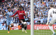 Rashford hóa chân gỗ