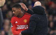 Bất ngờ với Anthony Martial