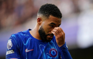 Cơn đau đầu dai dẳng của Chelsea