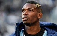 Những lựa chọn tiếp theo của Pogba sau khi tái xuất